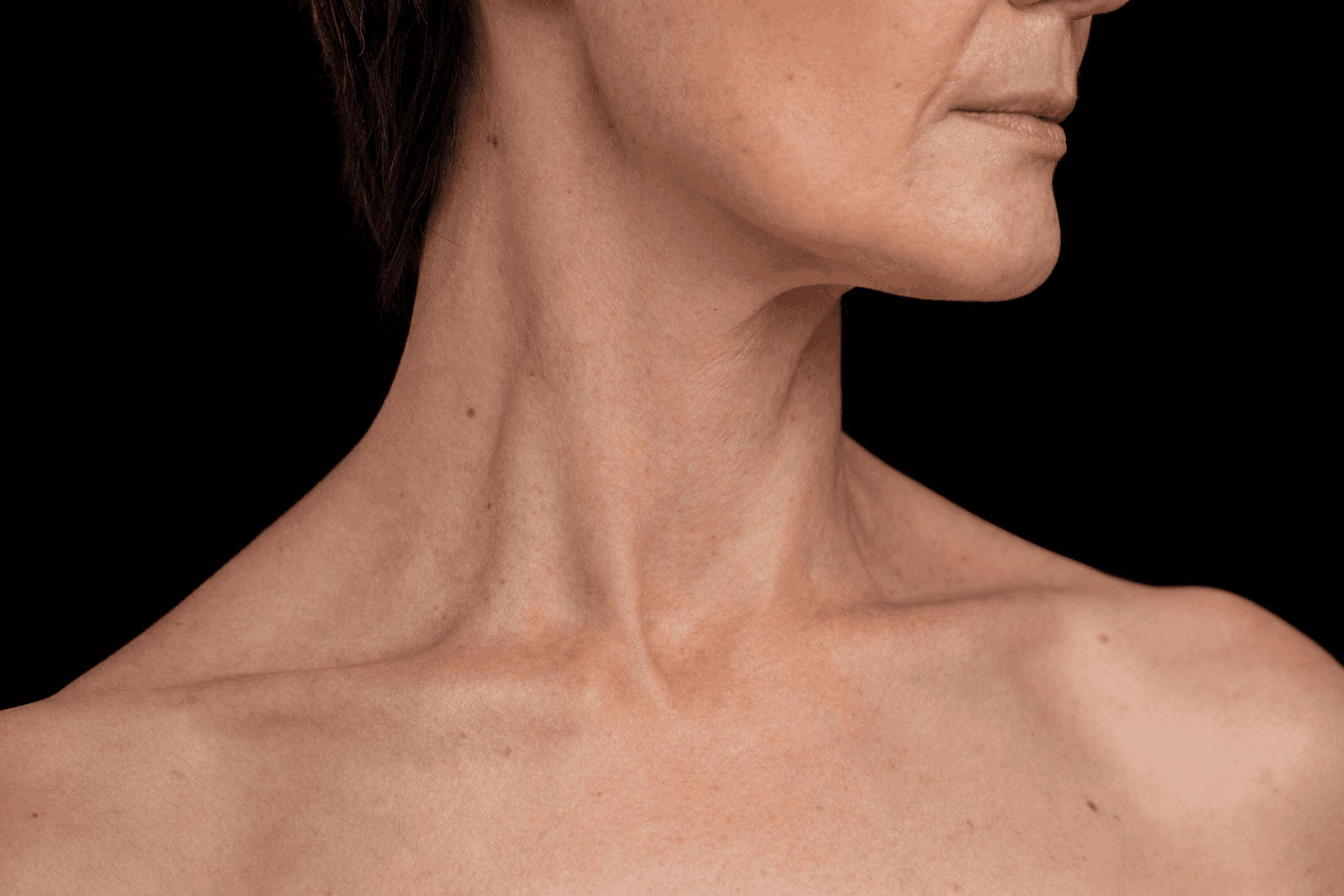 Liposuzione Collo
